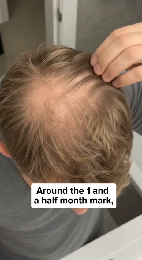 Korea's Secret To Fuller, Thicker Hair