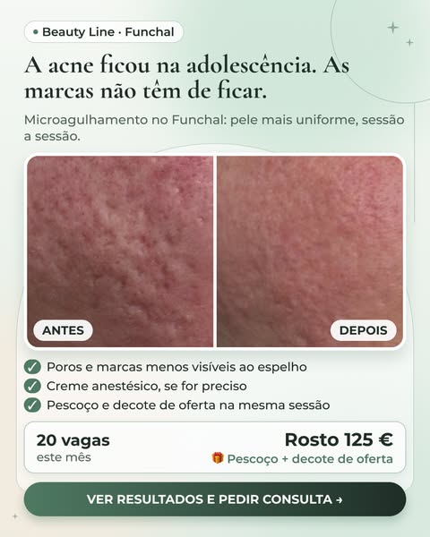 Vê os resultados reais no site