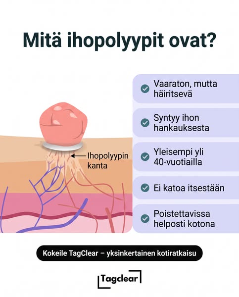 Mitä ihopolyypit oikeasti ovat?