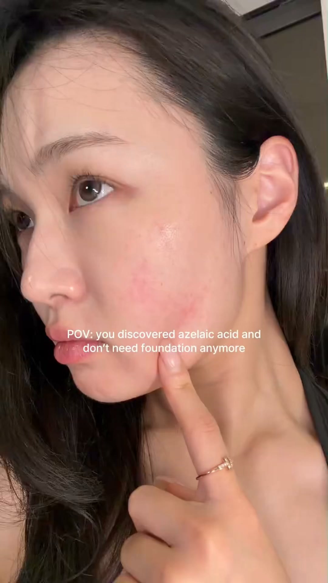 Calmer, Clearer-Looking Skin