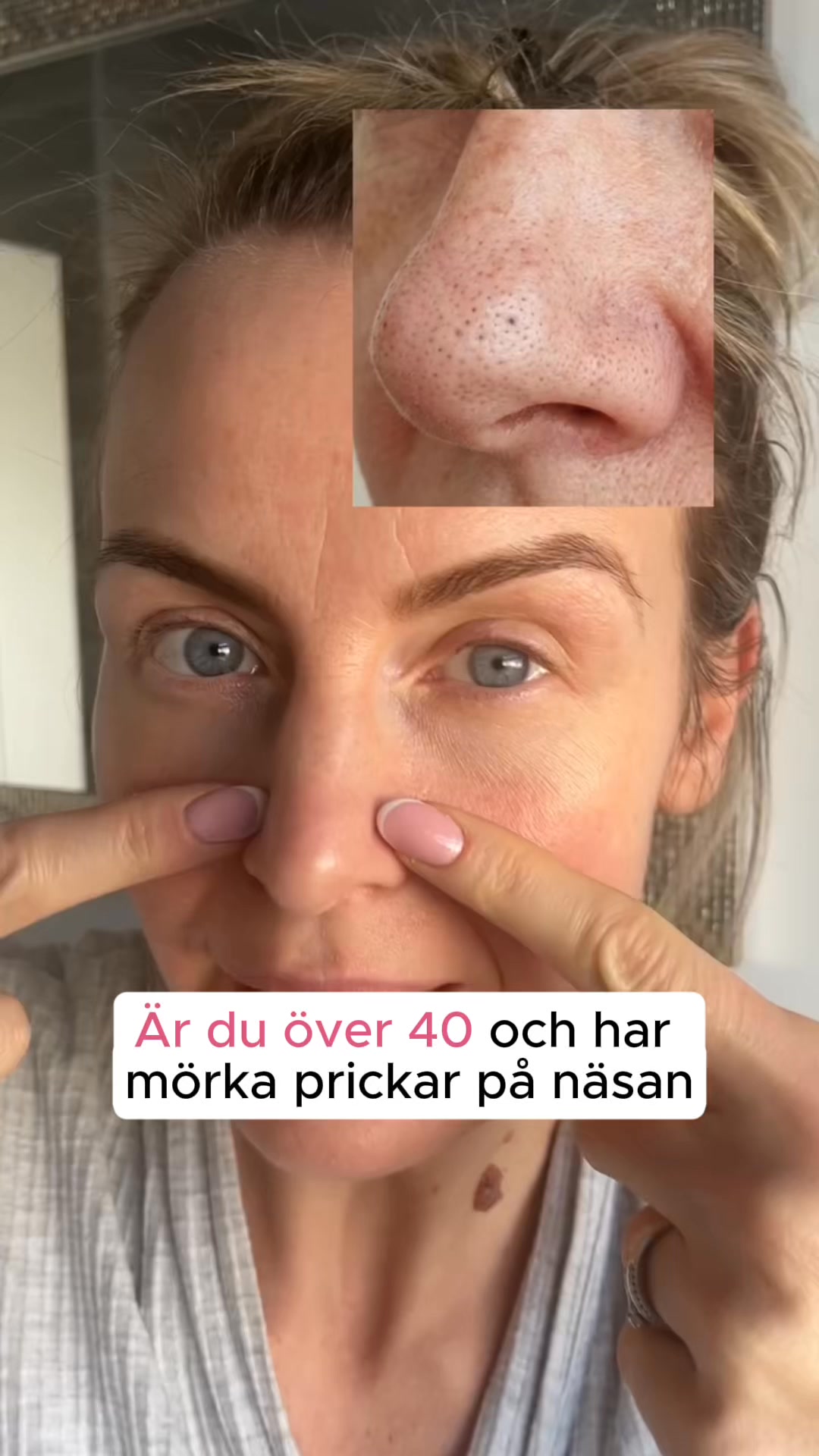 Känn dig bekväm med din hud igen