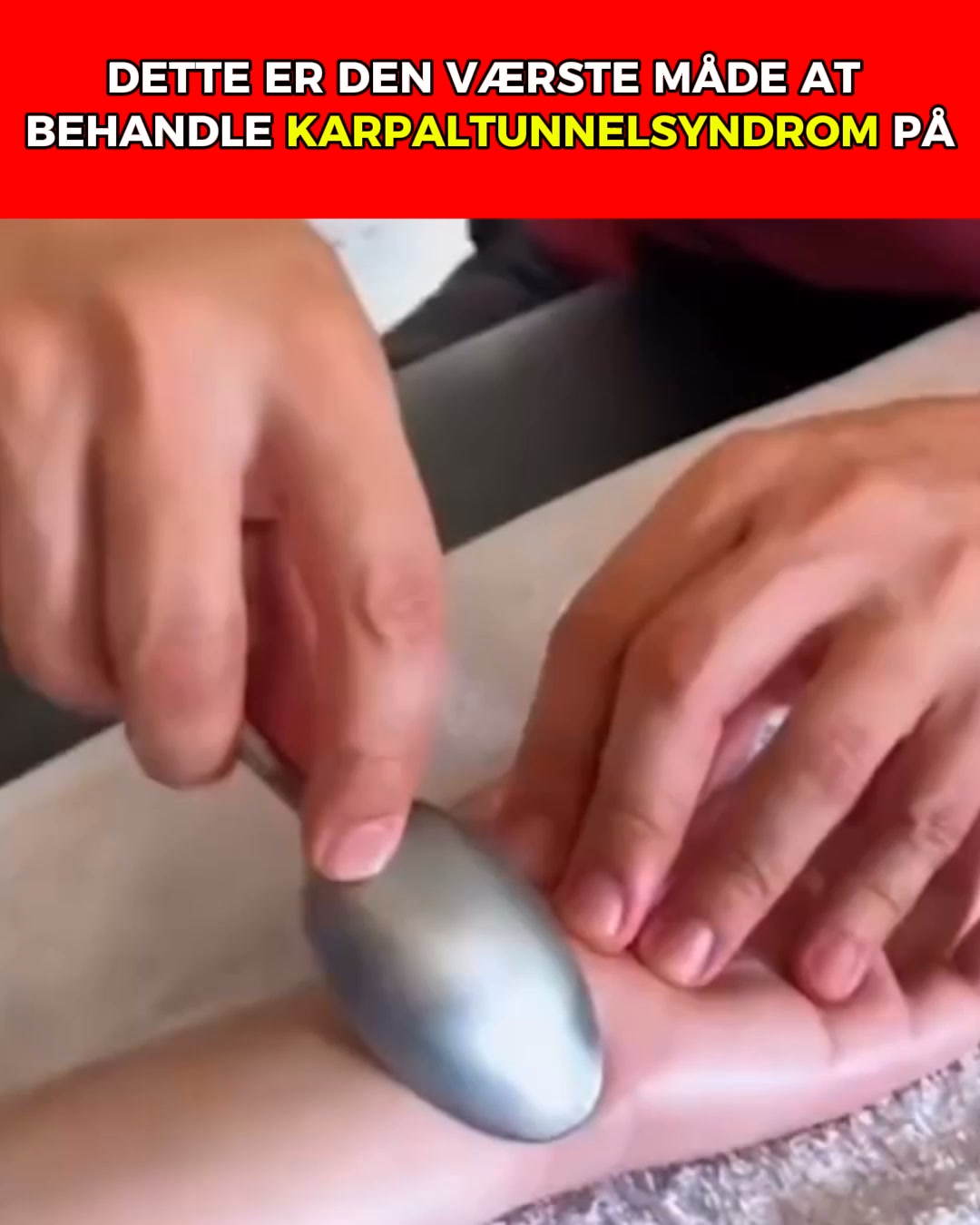 NYT: lindring af karpaltunnelsyndrom