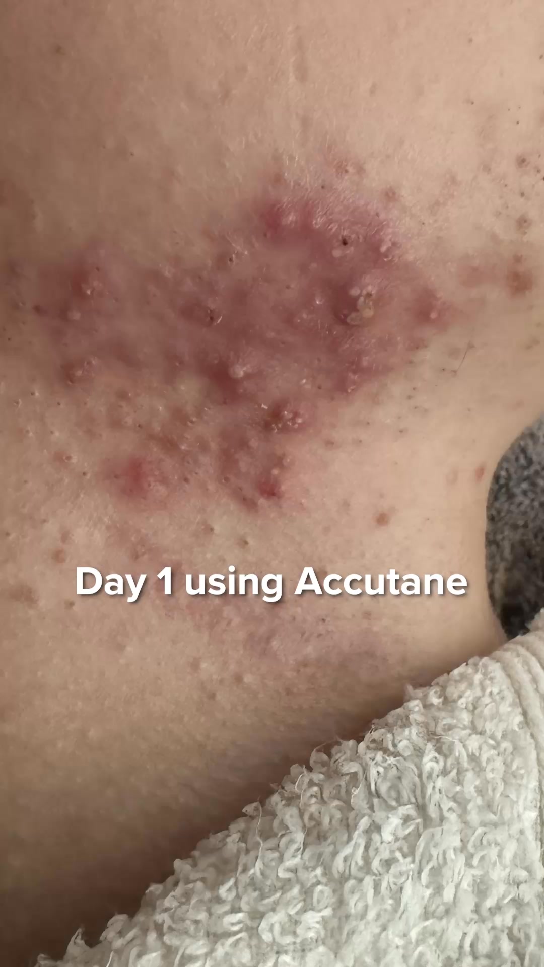 Stop Destroying Your Skin