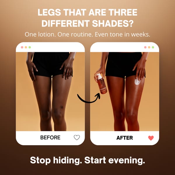 Dark Spots Don't Have To Be Forever
