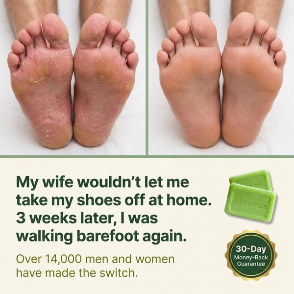 Say Goodbye to Fungal Rashes. For Good.