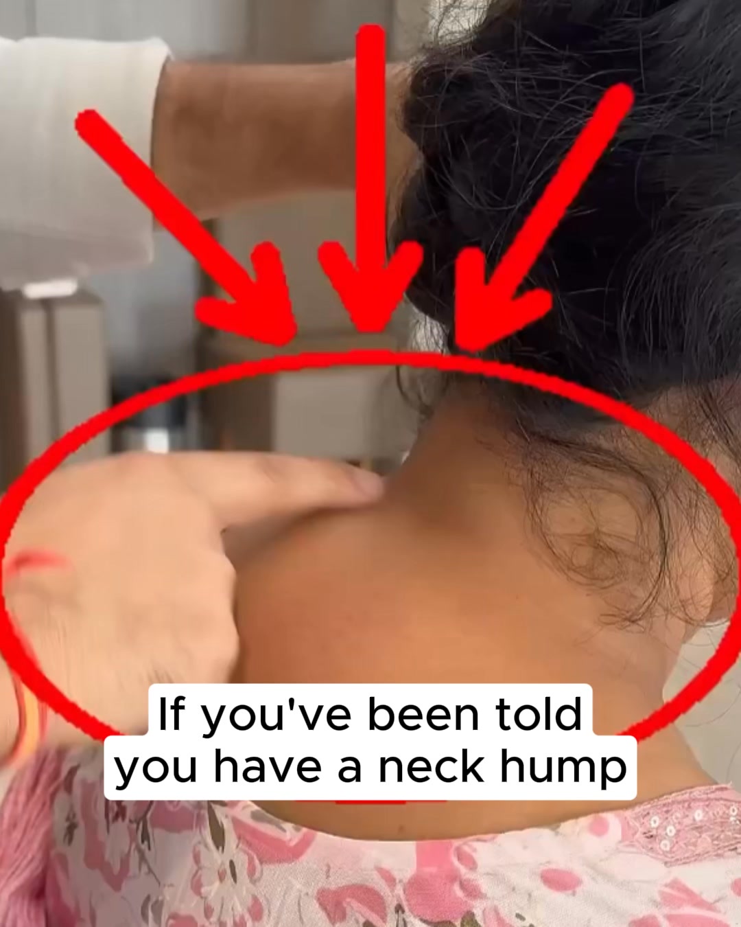 Reverse Neck Hump At Home