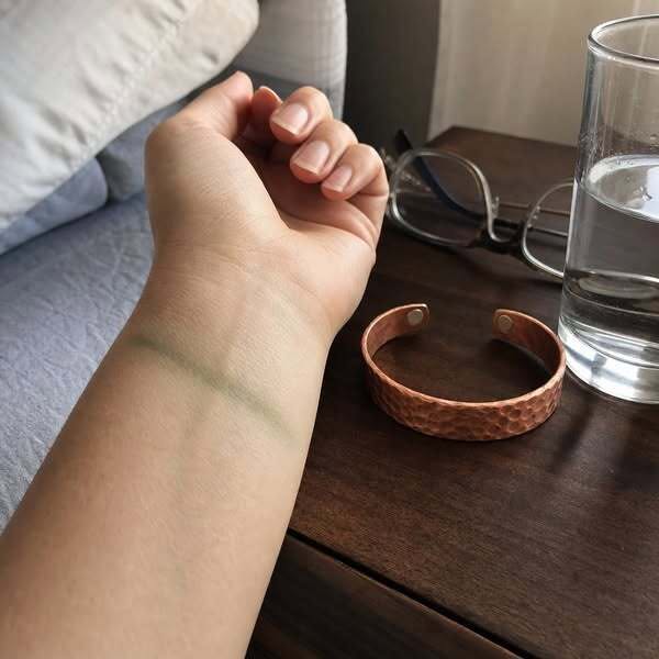 Usou uma pulseira de cobre durante um ano. O que aconteceu depois?