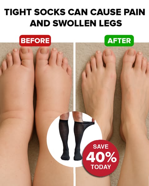 My friend found the solution – now I’m free from swollen legs! 4.8/5