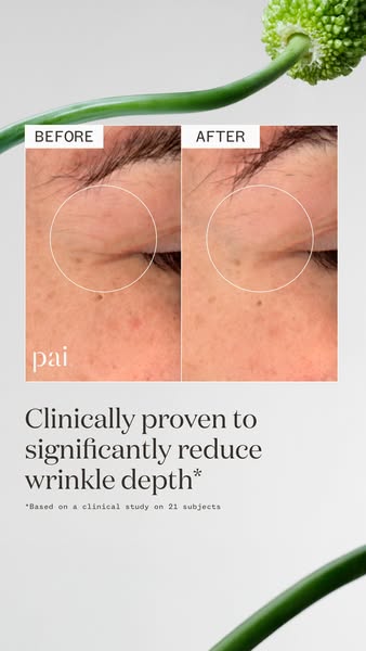 Reduces wrinkle depth
