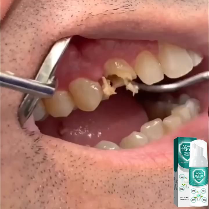 Anúncio de Fight QW-A1