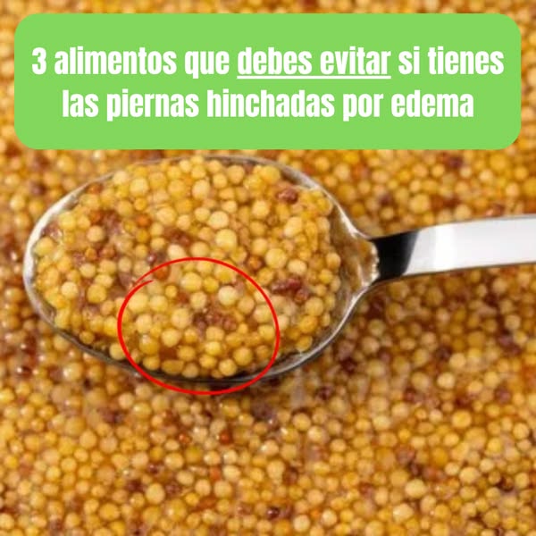 Equilibra la Hinchazón de Tobillos
