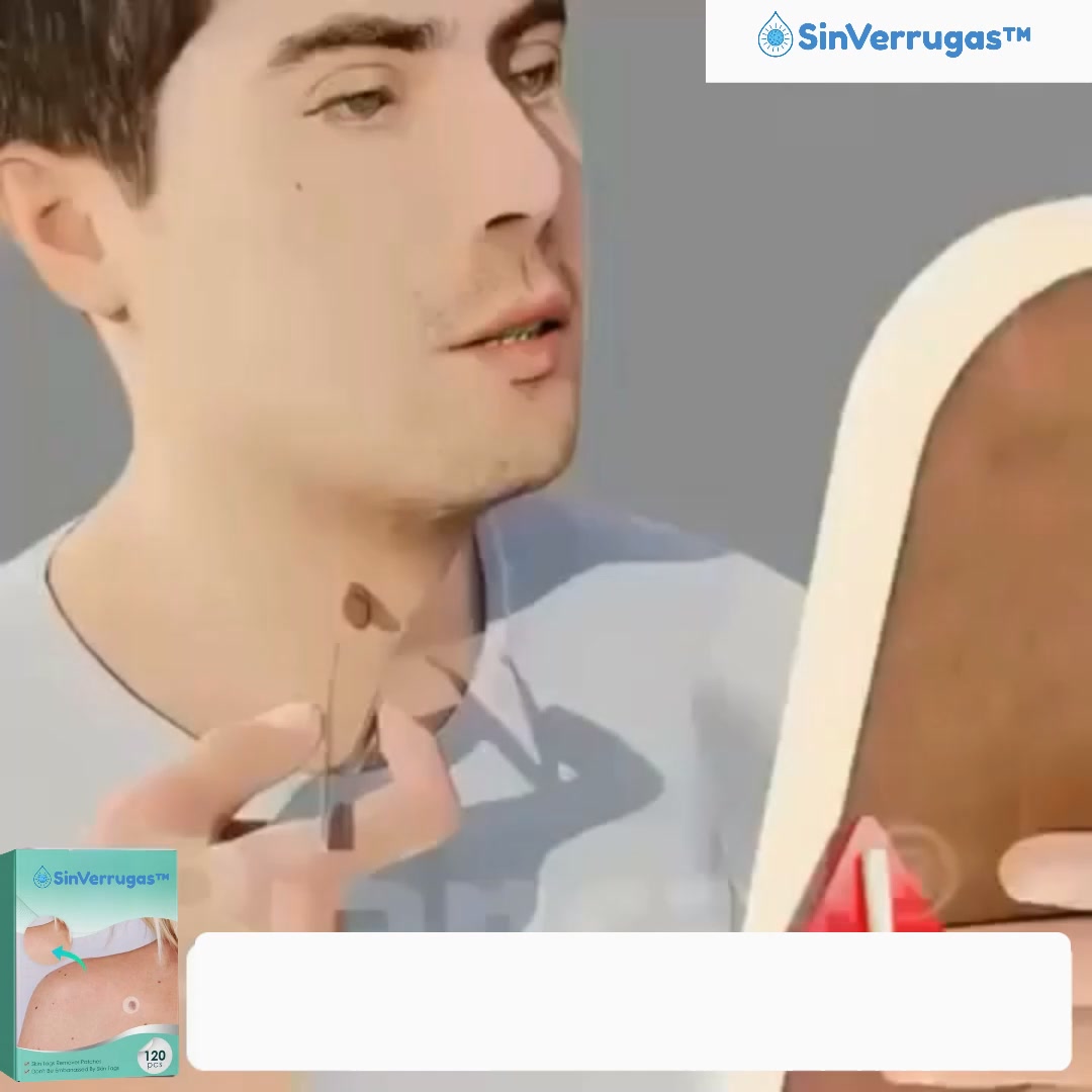 Elimina suavemente as verrugas e os sinais!