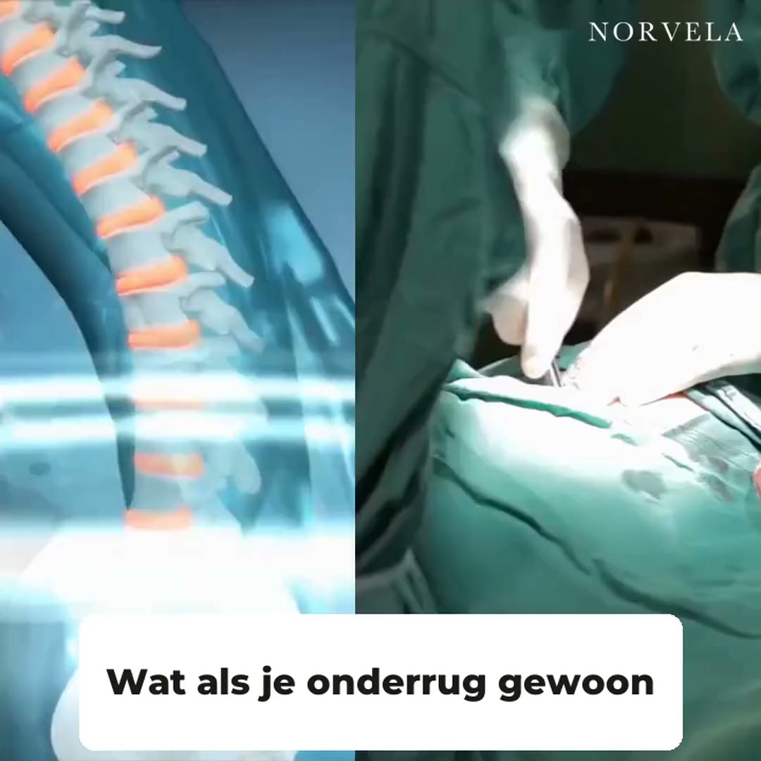 40% korting – Geef je onderrug weer ruimte