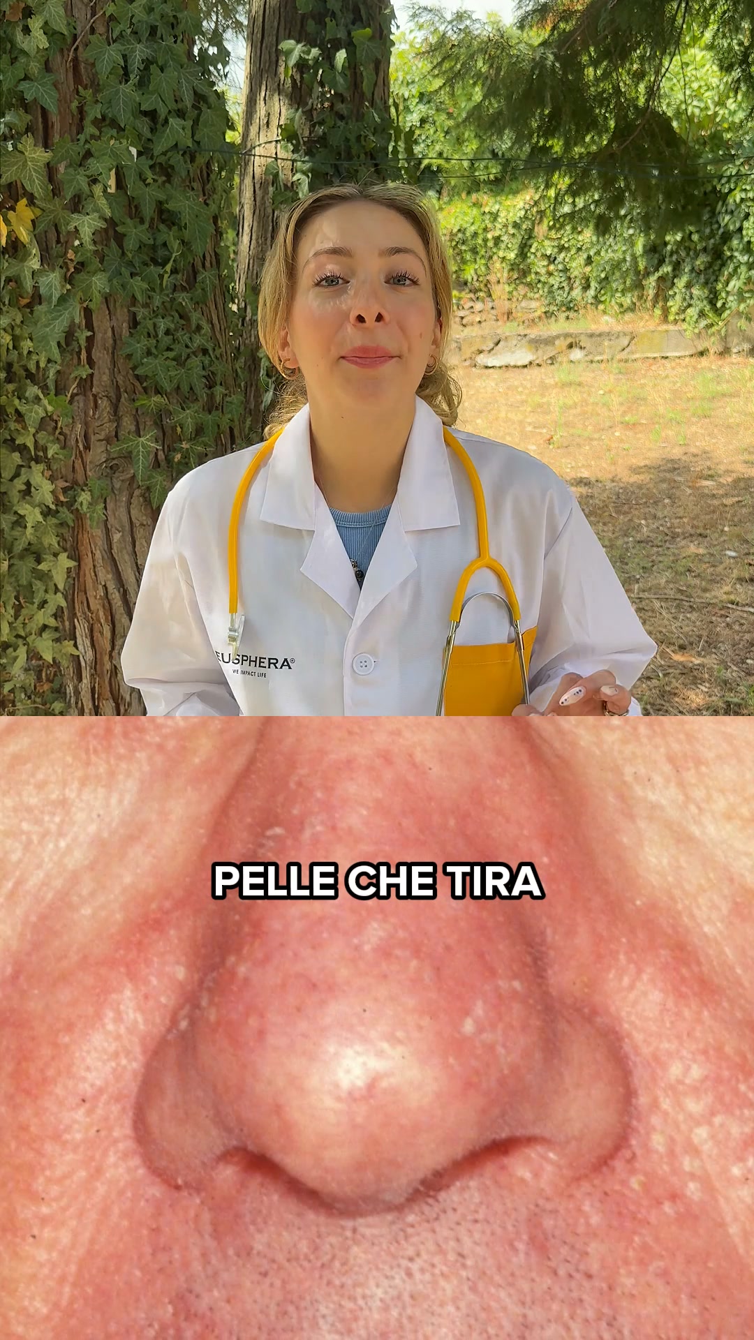 Supporto naturale per la tua Psoriasi