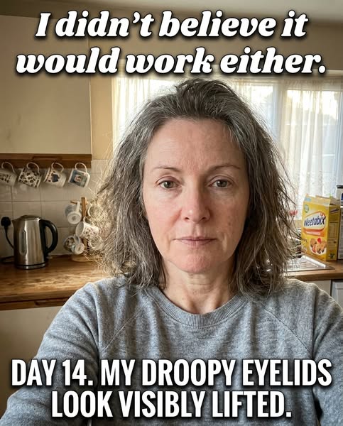 Your Droopy Eyelids Aren’t Aging — They’re a Collagen Deficiency. And Most Eye Creams Are Built For The Wrong Problem.