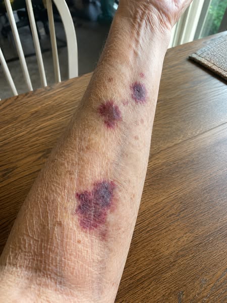 Why I Stopped Planning Around My Sleeves