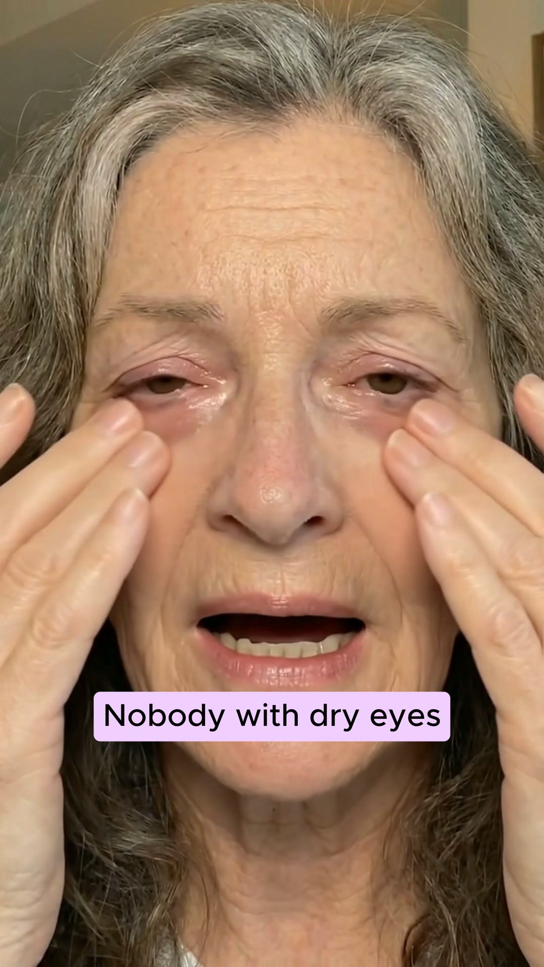 Never Use Eye Drops Again!