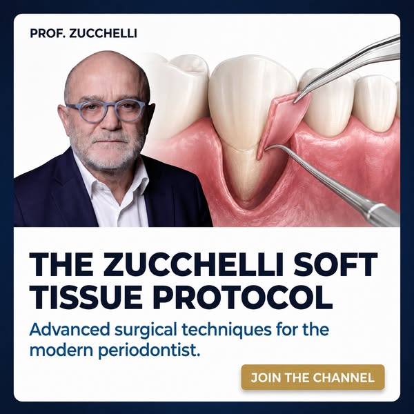Zucchelli Channel — Master Periodontal Surgery