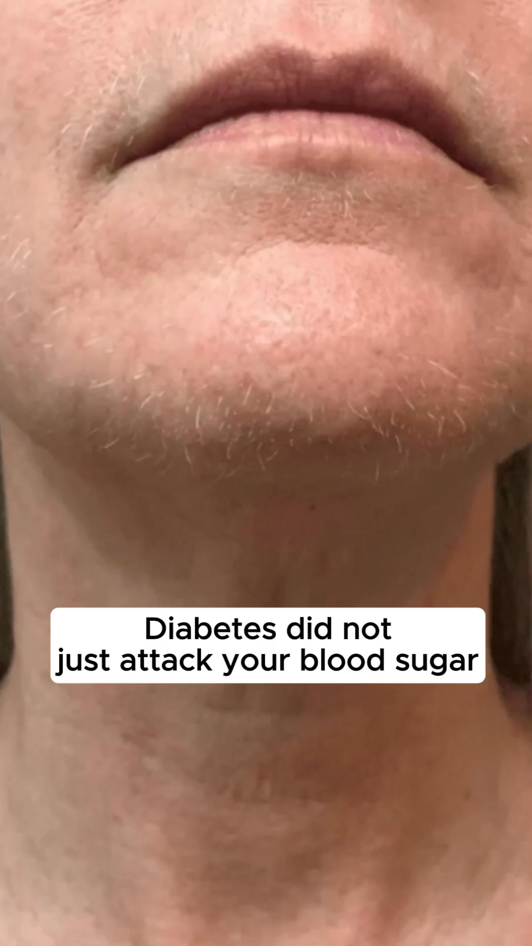 Diabetic Facial Hair Can Finally Be Stopped