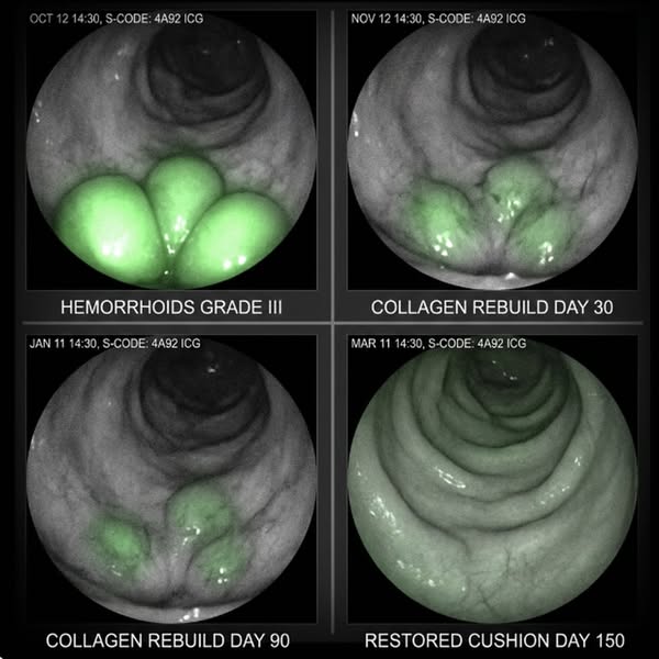 What Surgeons Don't Tell You