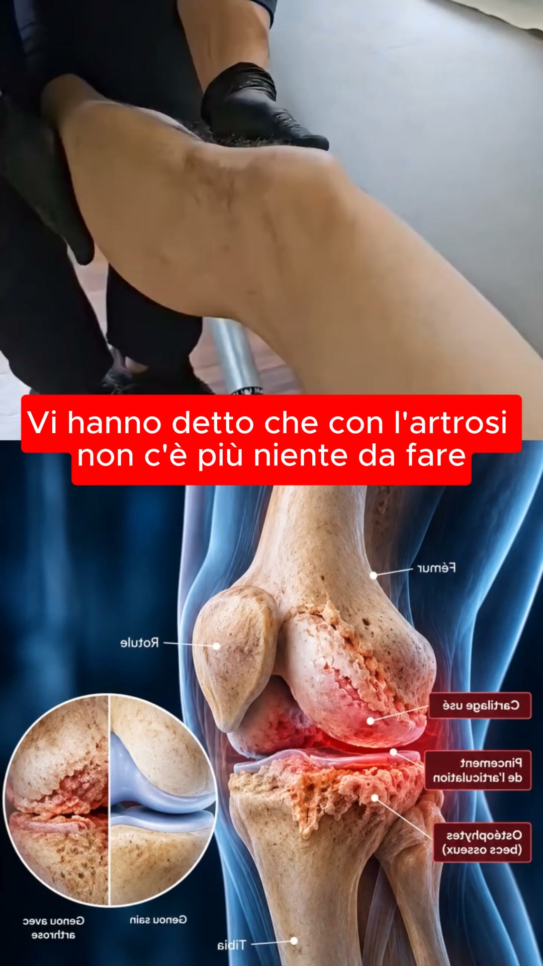 la discesa, non la salita