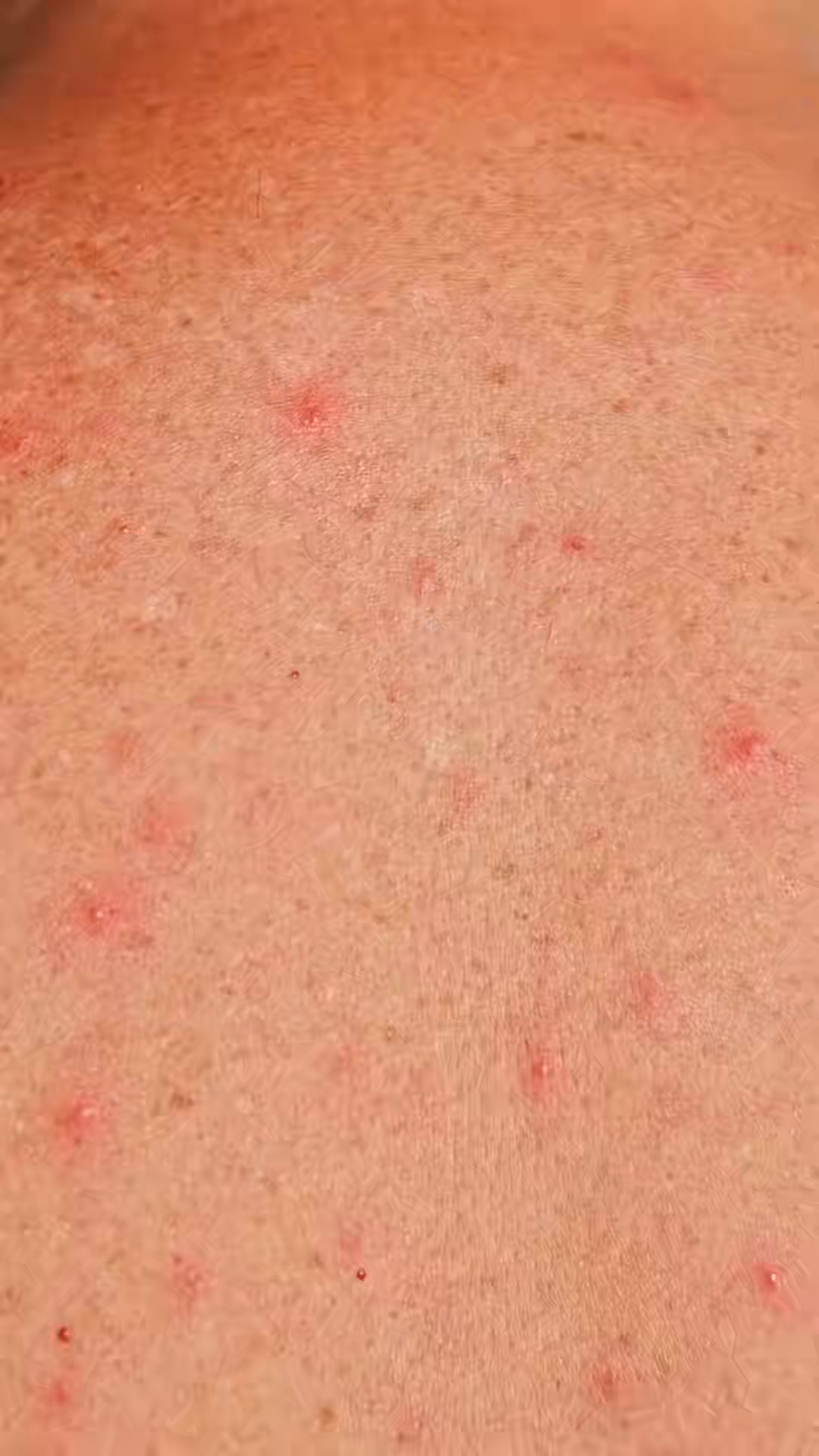 La «zona muerta de la higiene» que está arruinando tu piel