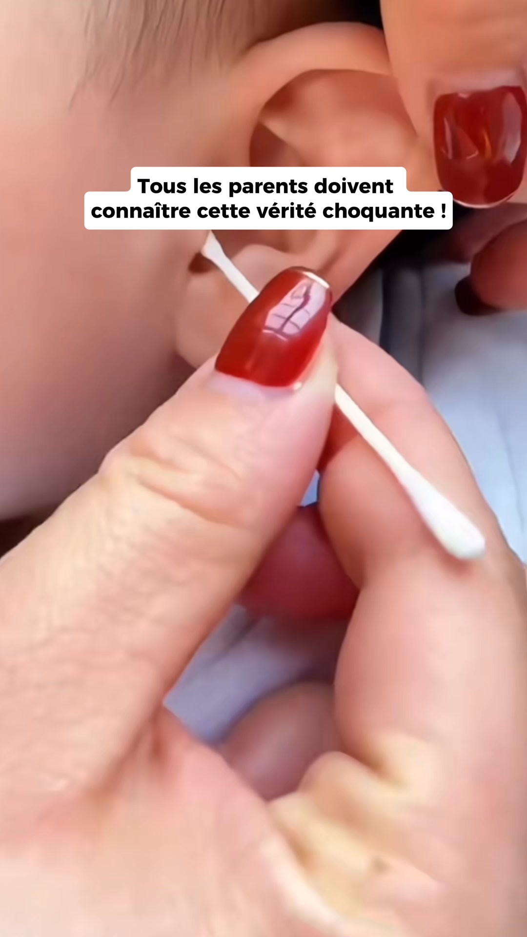 La solution validée techniquement par les ORL