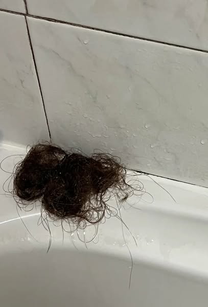 Thinning Hair? Read This.