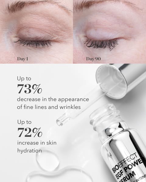 Best Serum for Lines and Wrinkles