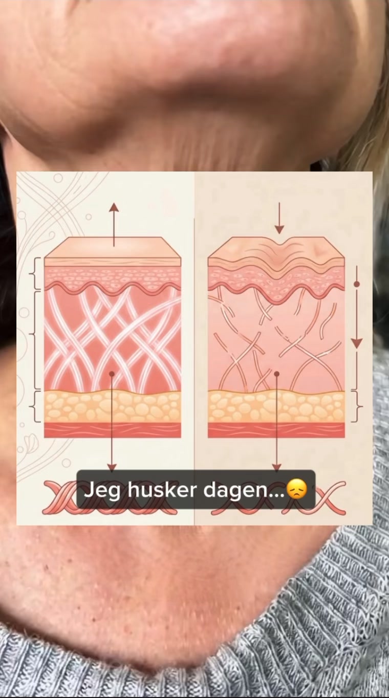 Farvel til løs hals – hej til fast, glat hud