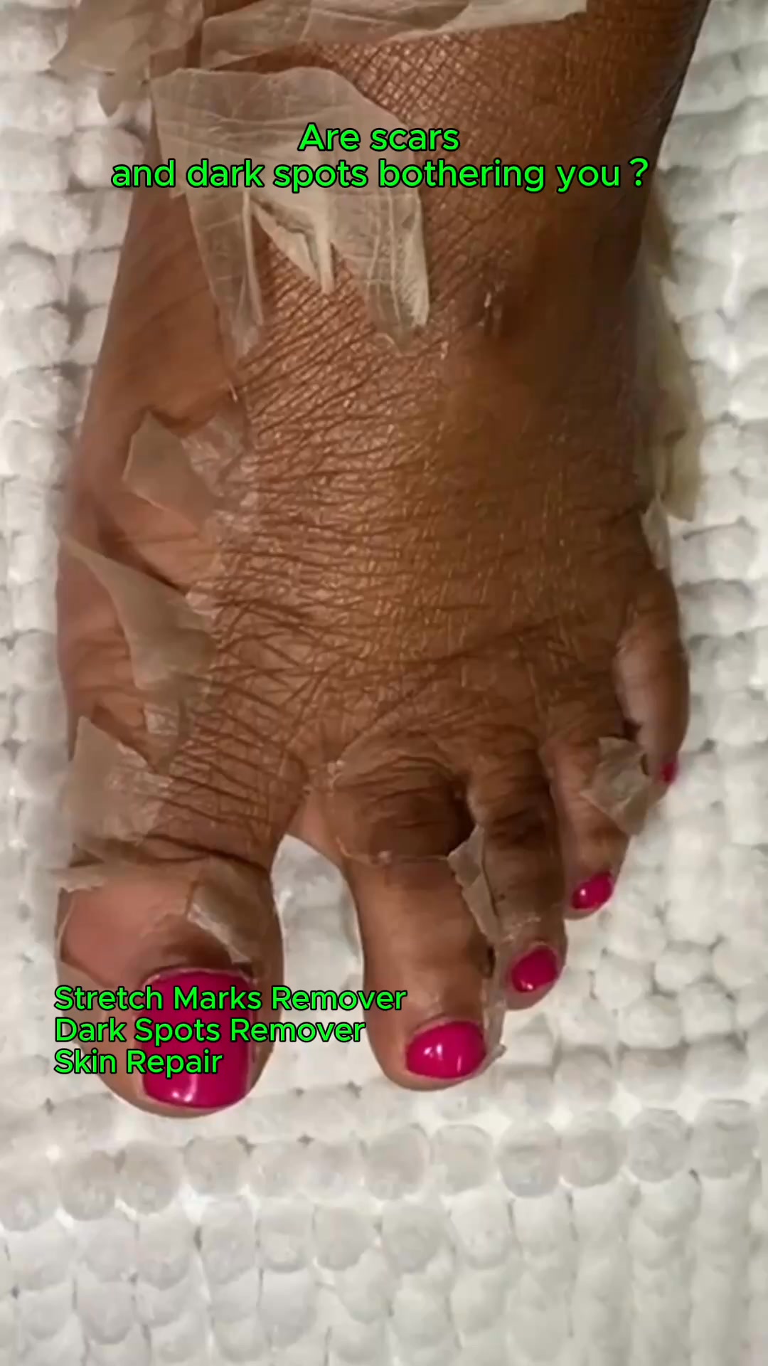Anúncio de Aussie Betta Skincare