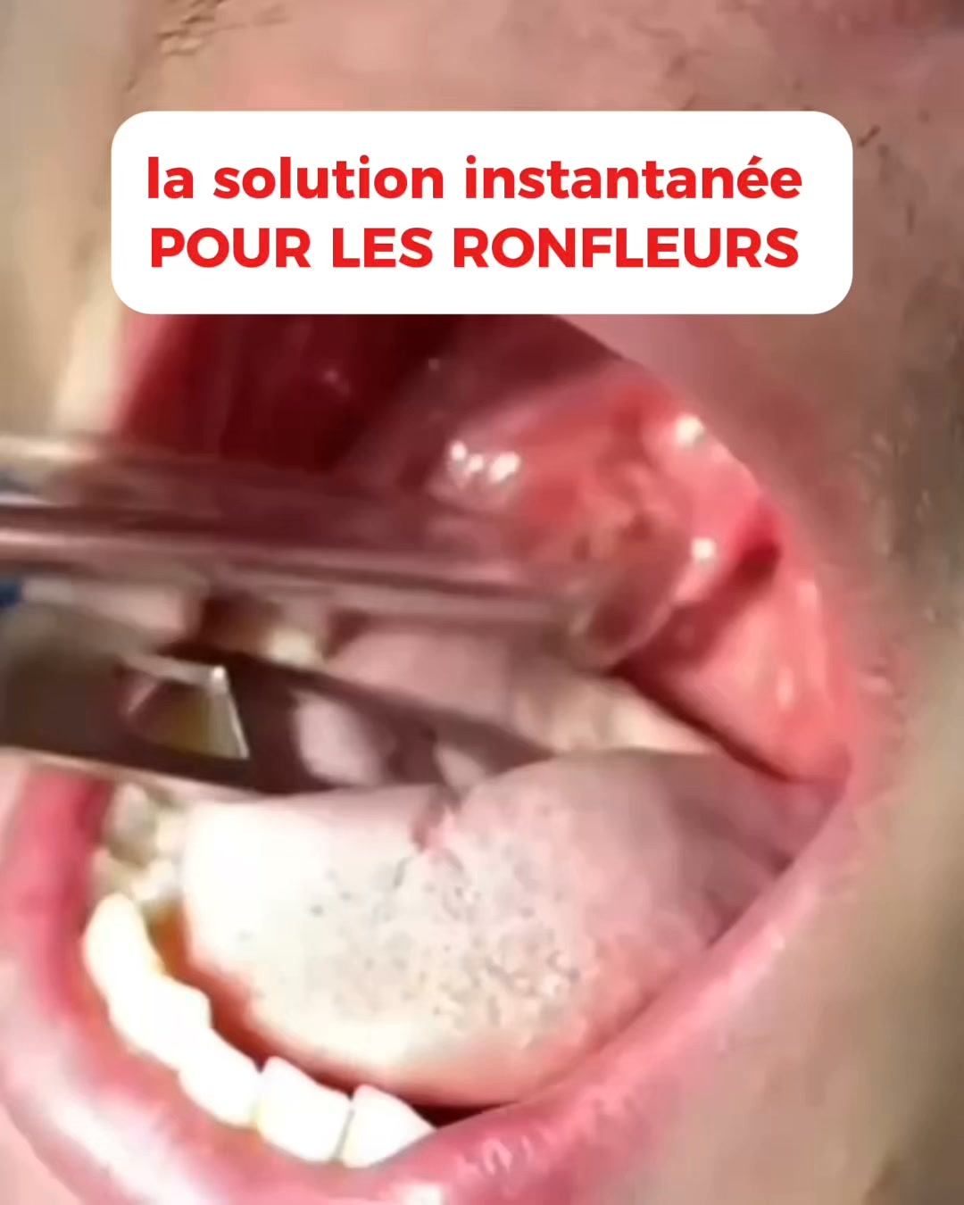 Ronflements : et si vous dormiez enfin mieux ?