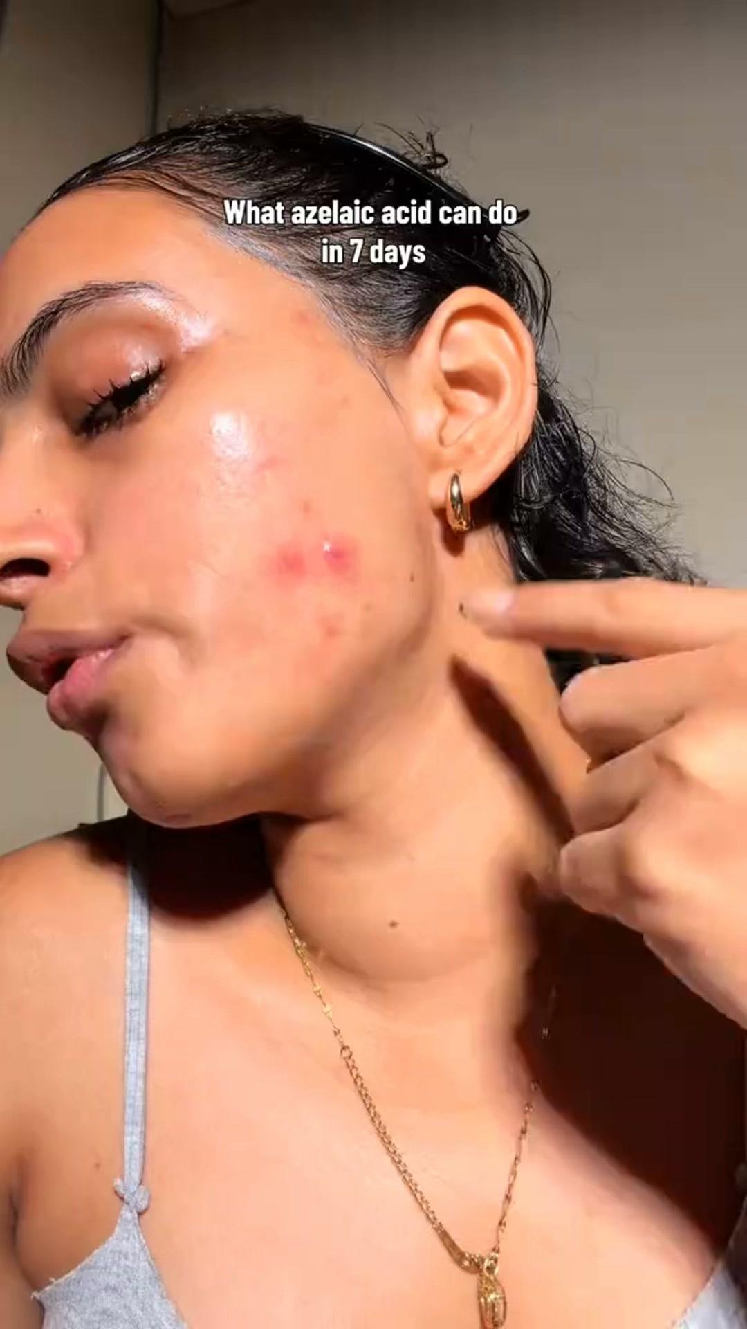 Calmer, Clearer-Looking Skin