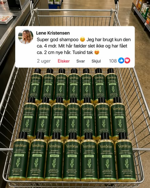Farvel hårtab — goddag nyt hår