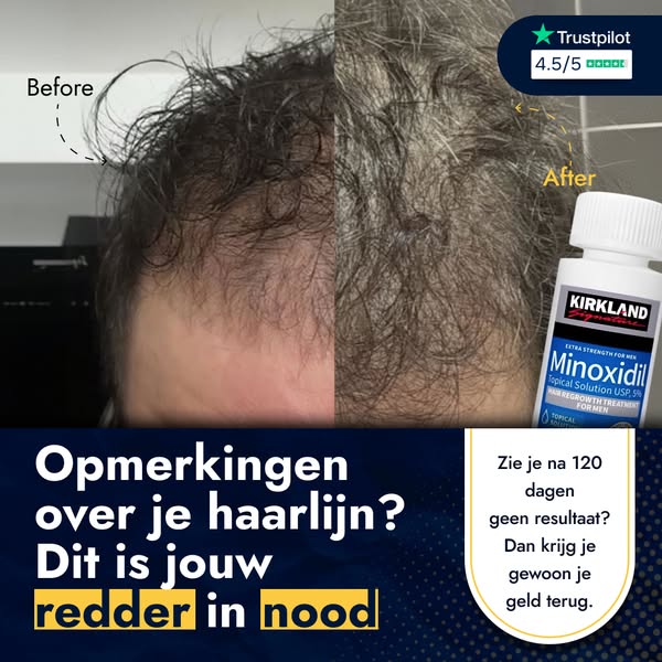 "Deze lotion gaf me dikker, gezonder haar"