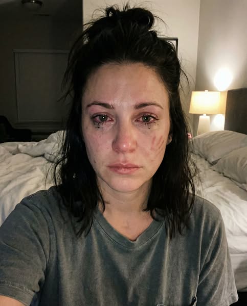 My 7yo punched me in the face