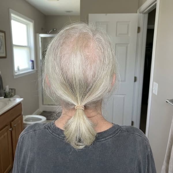 If Your Hair Is Thinning Read This