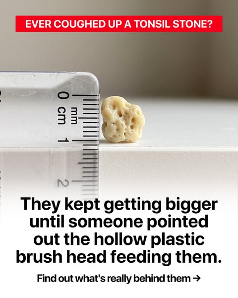 Up to 3,000x more bacteria on hollow heads