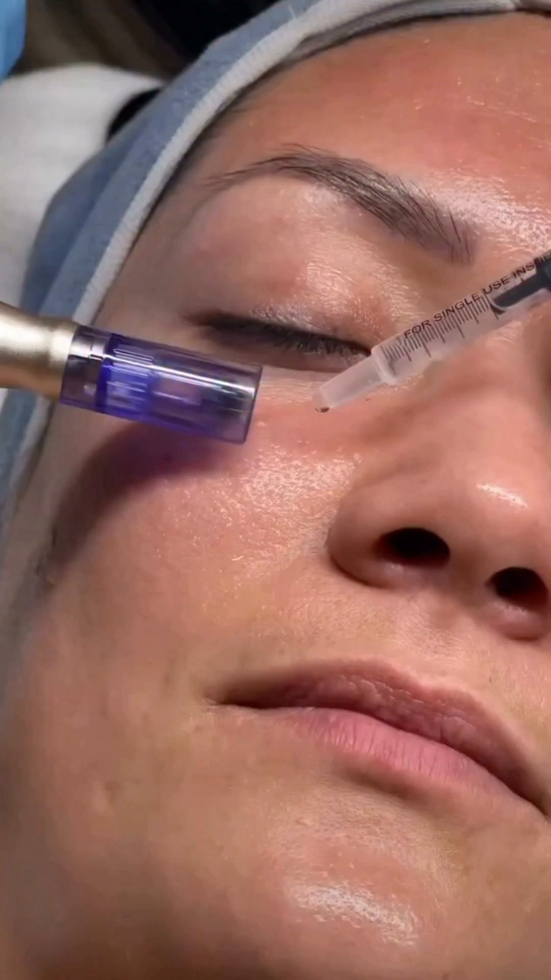 Take Your Skin Beyond Skincare – £75