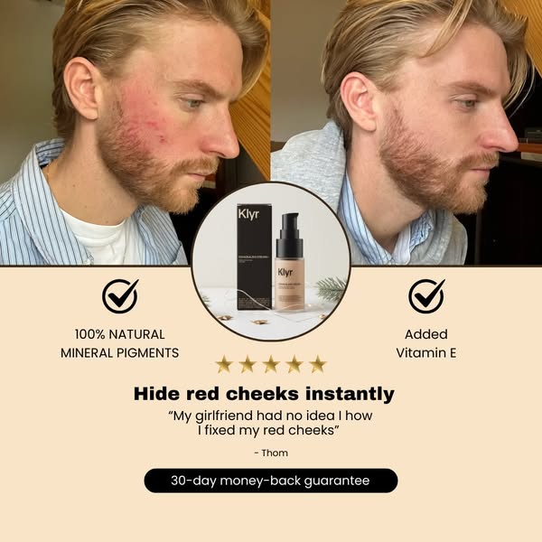Clear skin. No redness!