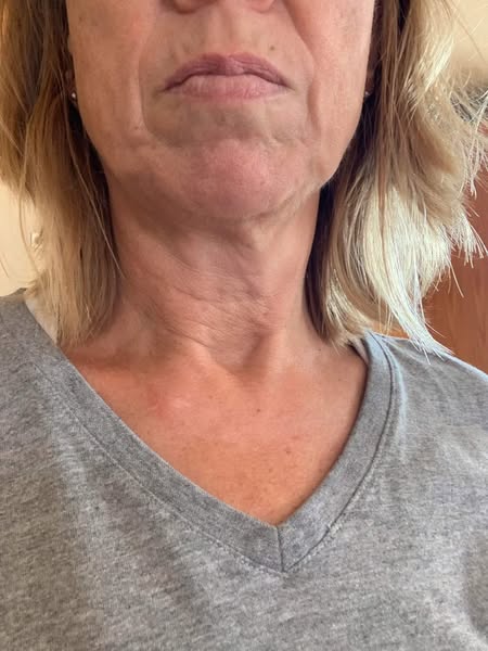 My answer for aging skin nothing could fix + my husband finally noticing my face again