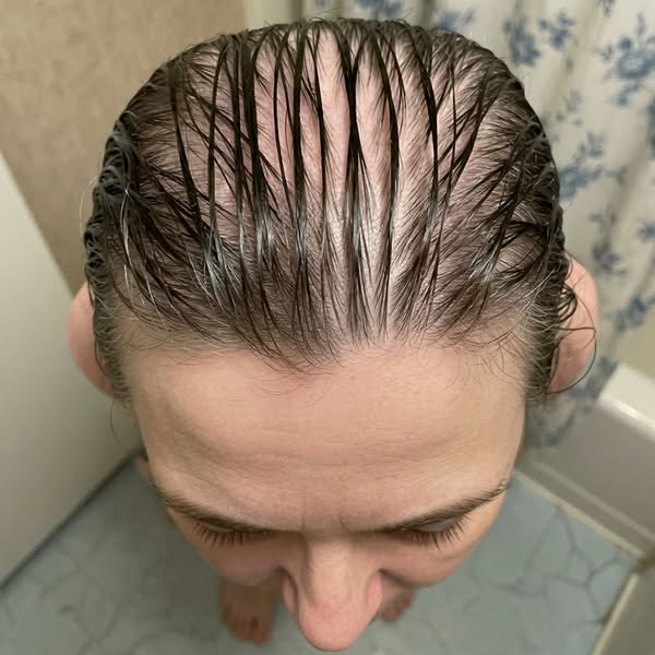 My answer for losing my hair + energy