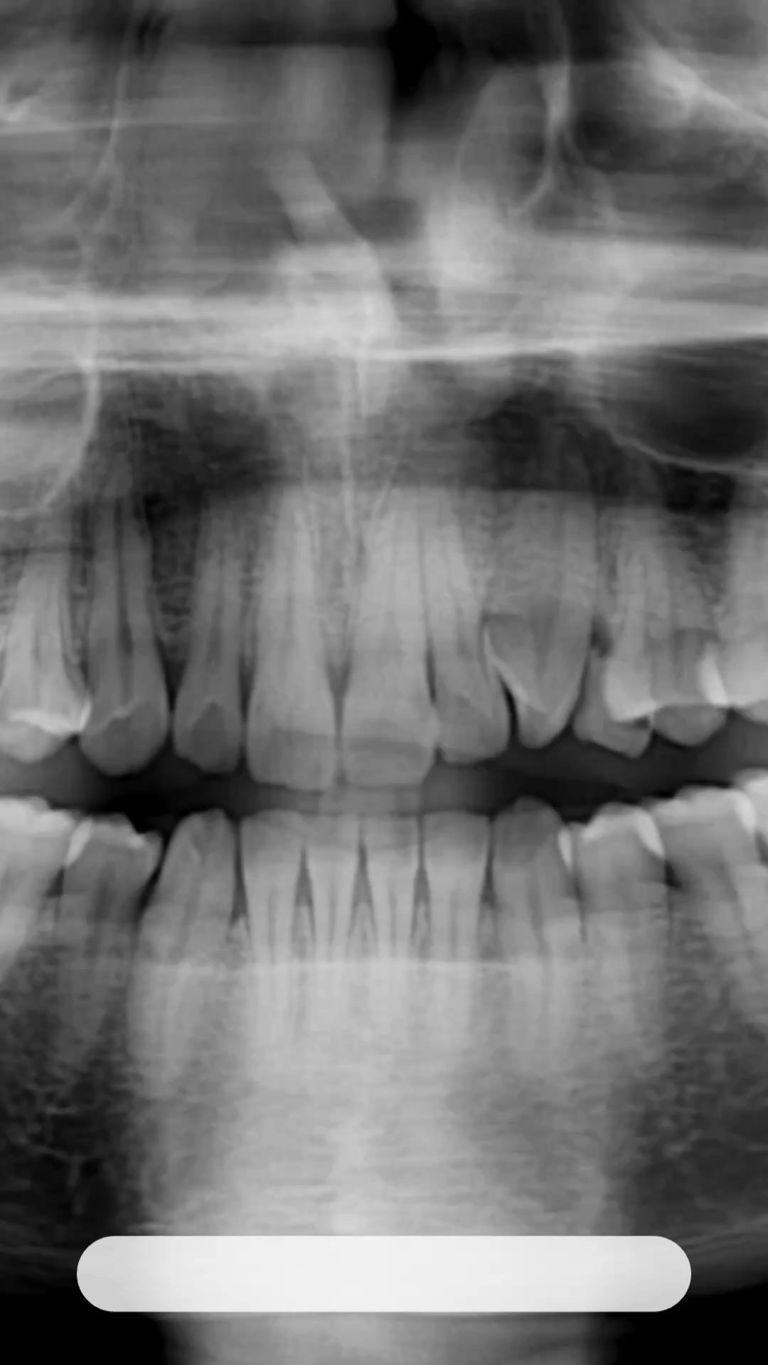 £65 New Patient Dental Assessment