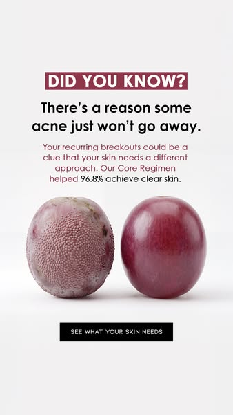 Maybe It Isn’t Just Stubborn Acne