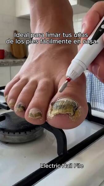 ¿Uñas gruesas y duras? ¡Cuida tus uñas fácilmente! ¡Olvídate de la molestia de recortar las uñas gruesas con esta lima eléctrica!