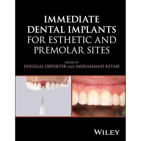 Immediate Dental Implants for Esthetic and Premolar Sites 1st Edition - 2025