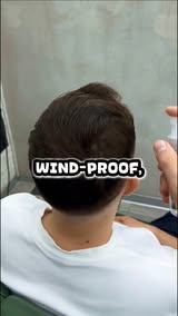 Seeing More Scalp Lately?