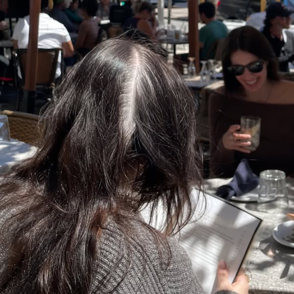 Why Her Hair Stayed Thick and Mine Didn't