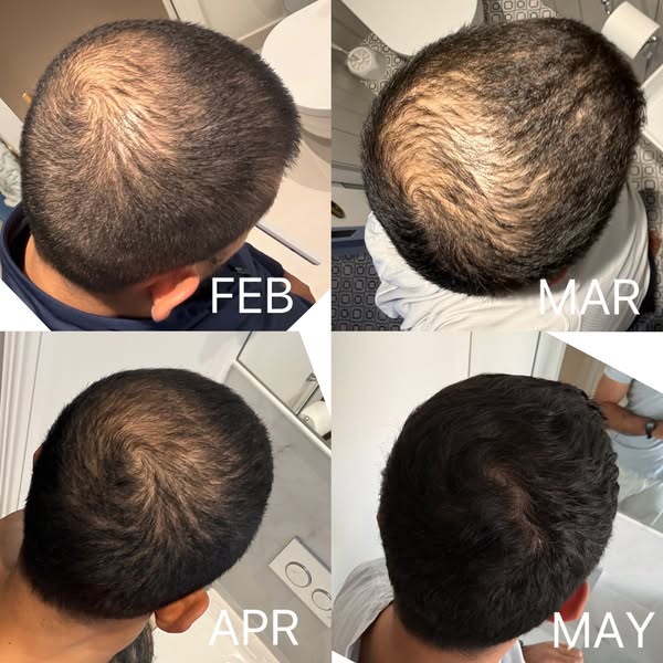 8 Months/ No Pharmaceuticals