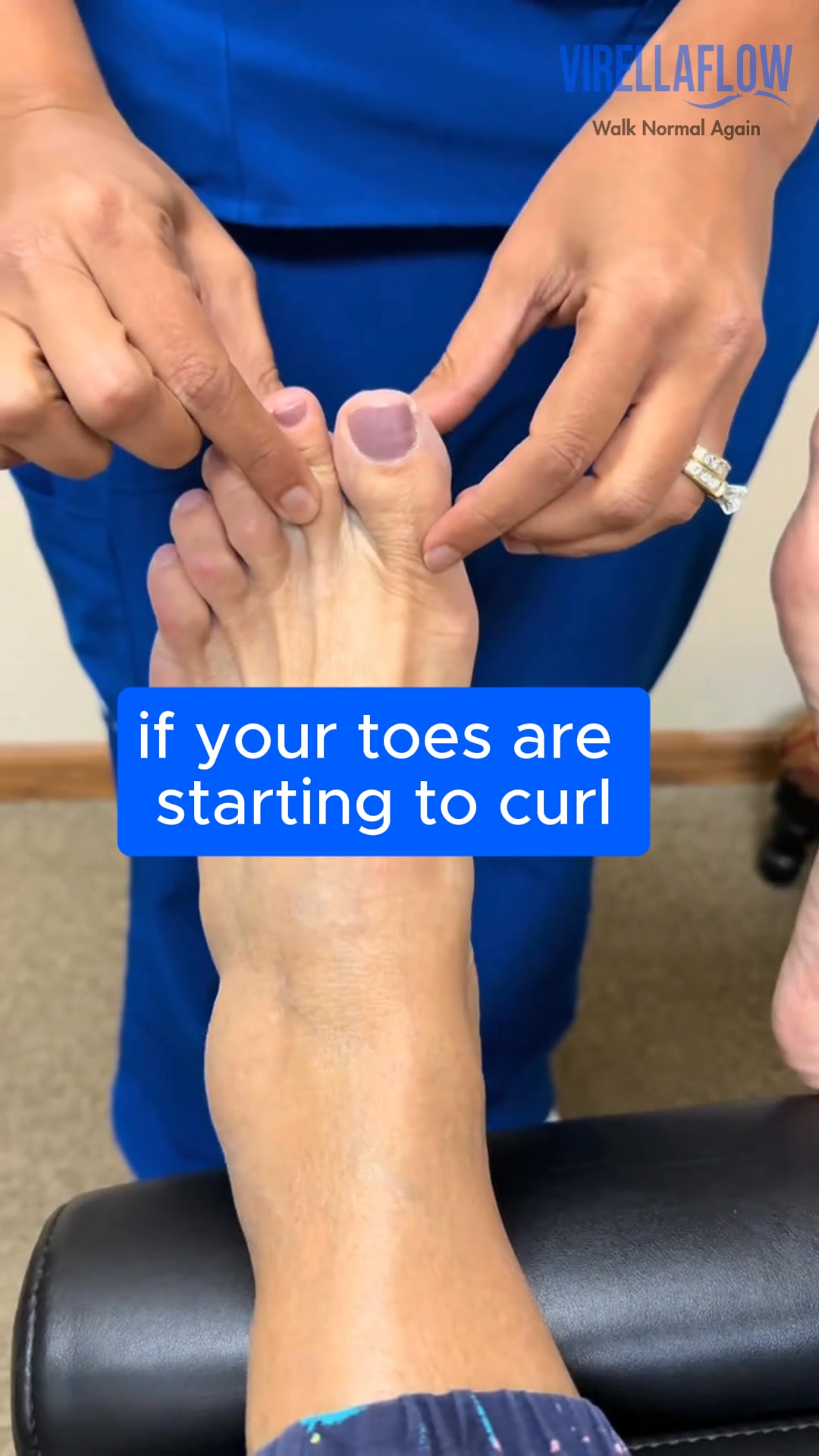 The best way to fix your hammertoes